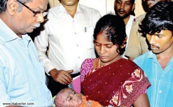 Doğumundan bir hafta sonra rahatsızlanan Rahul bebek, annesi ve babası tarafından hemen hastaneye kaldırıldı.