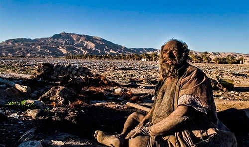 60 yıldır yıkanmayan adam, hijyenik olmayan bir çevrede, kötü bir yaşam sürmeye devam ediyor.