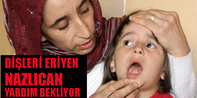 Dişleri Eriyen Nazlıcan Yardım Bekliyor