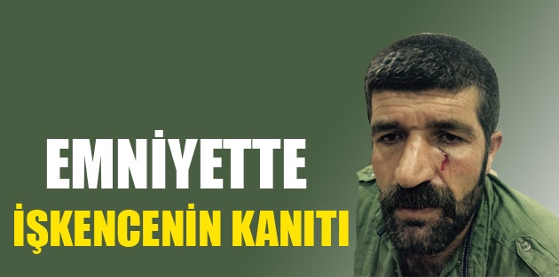 Emniyette işkencenin kanıtı