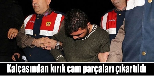 Kalçasından kırık cam parçaları çıkartıldı