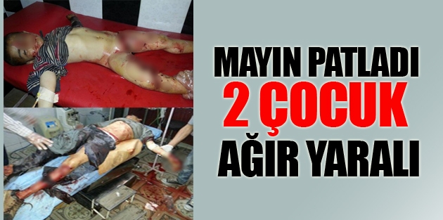 Mayın patladı, 2 çocuk ağır yaralı