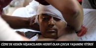 Cizre'de keskin nişancıların hedefi olan çocuk...