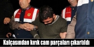 Kalçasından kırık cam parçaları çıkartıldı